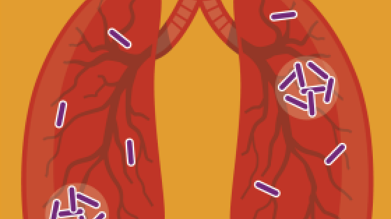 Cartoon Lung